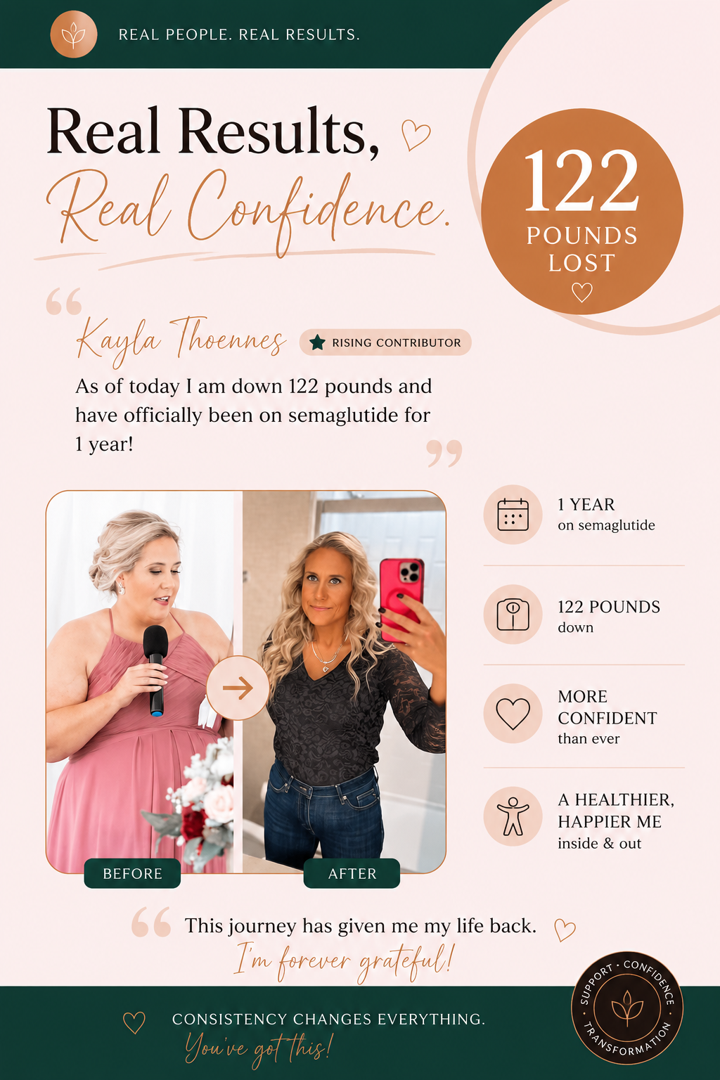 Kayla Thoennes — 122 pounds lost over one year on semaglutide